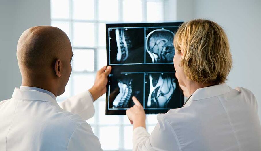 diagnostic de l'ostéochondrose cervicale par images