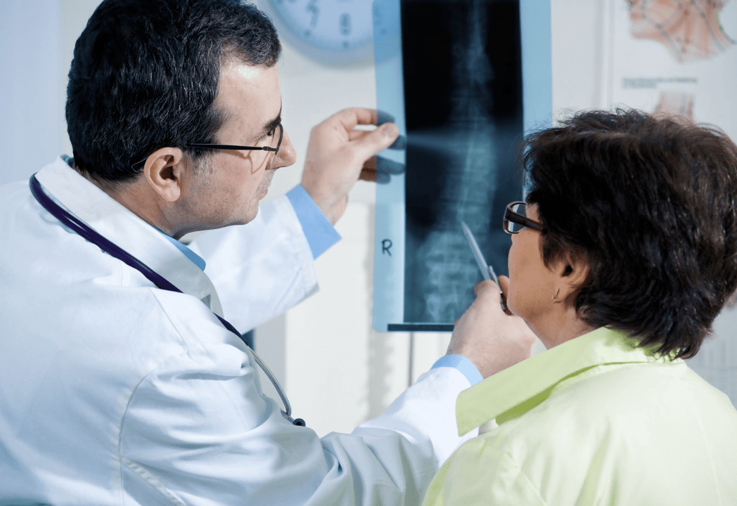 Un neurologue diagnostique l'ostéochondrose à l'aide d'une radiographie de la colonne vertébrale